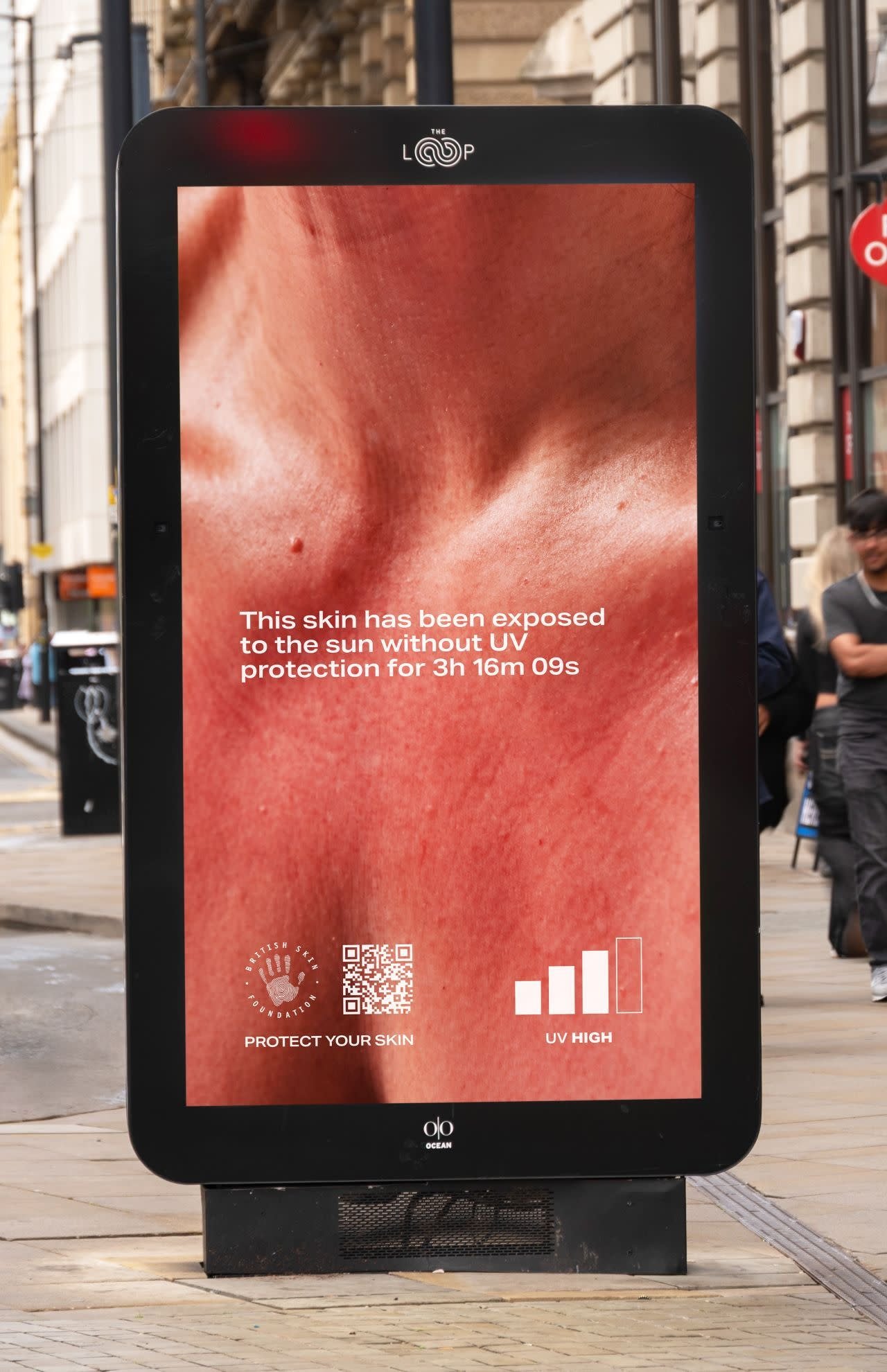 sunburn_bus_shelter